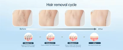 OEM Tragbares Permanentes IPL-Laser-Haarentfernungsgerät